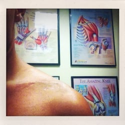Nicholas Colyvas, MD - Progress report: Minimal scarring, collarbone in alignment, healing nicely. :)
