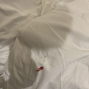 The Spa at MacArthur - Blood stained comforter - Massage Near Me - Sonoma, California The Spa at MacArthur - Blood stained comforter - Massage Near Me - Sonoma, California