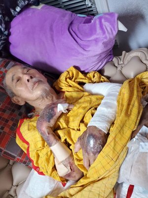 Photo of Regional Medical Center - San Jose, CA, US. My grandpa came home with swollen hands and arms that were caused by the hospital staff.