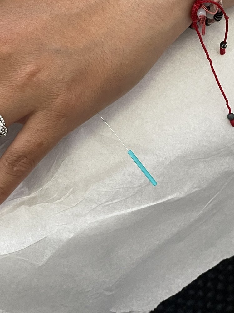 HUANG’S ACUPUNCTURE CENTER 11 Photos & 29 Reviews 3900 Geary Blvd