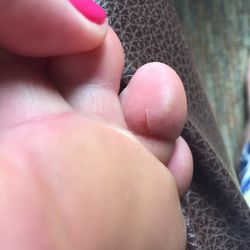 Paris Nails II - Cut on toe.