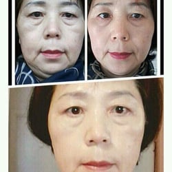 Eunyoung Park Aesthetics - One of eunyoung park aesthetics anti-aging treatment program with korean style hand massge.