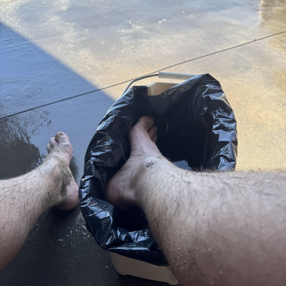 Bolsa Chica State Beach - Foot in HOT water treating a stingray sting!! - Beaches Near Me - Huntington Beach, California Bolsa Chica State Beach - Foot in HOT water treating a stingray sting!! - Beaches Near Me - Huntington Beach, California