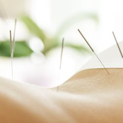 Boulder Bodyworks - Acupuncture supports pain relief, digestive health, hormonal balance, sleep quality, and nervous system regulation.
