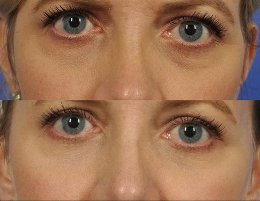 b12 injections exton pa THE BEST 10 IV HYDRATION NEAR EXTON, PA 19341 - UPDATED JUNE 2026 - HOURS