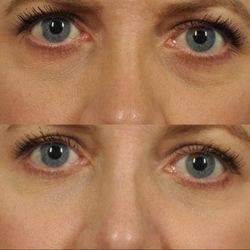 W Cosmetic Surgery - W Cosmetic Surgery