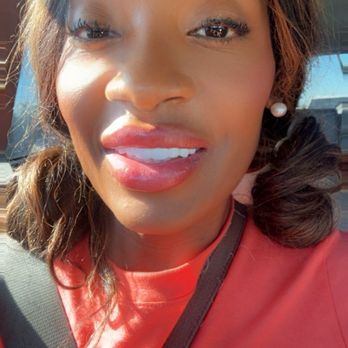 Temecula Dental Implants & Oral Surgery - After temporary teeth - Oral Surgeons Near Me - Temecula, California Temecula Dental Implants & Oral Surgery - After temporary teeth - Oral Surgeons Near Me - Temecula, California
