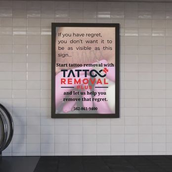 Tattoo Removal Plus - Tattoo Removal Near Me - South Gate, California Tattoo Removal Plus - Tattoo Removal Near Me - South Gate, California