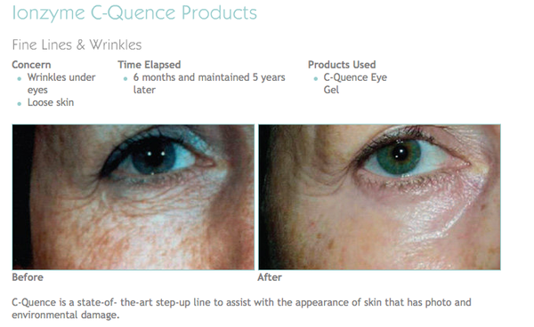 You Rejuvenated by null