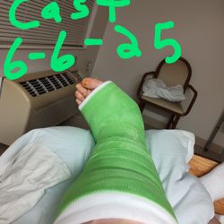 Orthopaedic Institute of Ohio - This is the bright neon cast that got put on for no weight lifting.