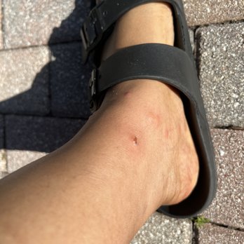 Fantasy World Resort - ***BUG BITES*** - Hotels Near Me - Kissimmee, Florida Fantasy World Resort - ***BUG BITES*** - Hotels Near Me - Kissimmee, Florida