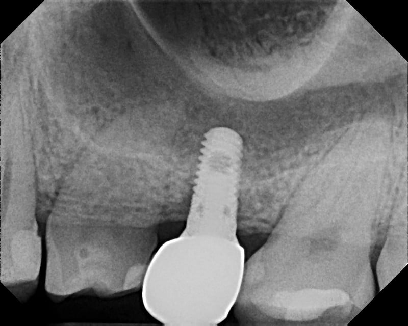 DENTAL IMPLANTS HAWAII Updated October 2024 17 Photos 3221 Waialae Ave, Honolulu, Hawaii