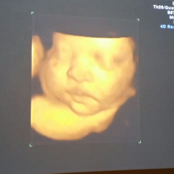 Baby's Close-Up - Jionni - Ultrasound Imaging Centers Near Me - Jacksonville, Florida Baby's Close-Up - Jionni - Ultrasound Imaging Centers Near Me - Jacksonville, Florida