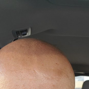 SMP INK - Hair Loss Centers Near Me - Las Vegas, Nevada