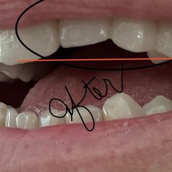 Affinity Dental of La Mesa