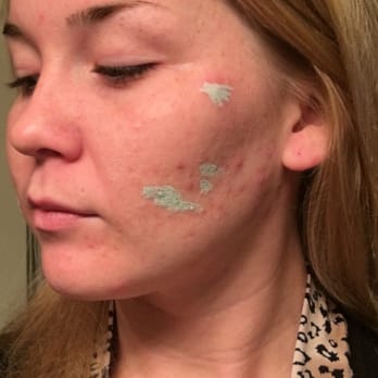 Zara Med Spa - Skin Care Near Me - Chula Vista, California Zara Med Spa - Skin Care Near Me - Chula Vista, California