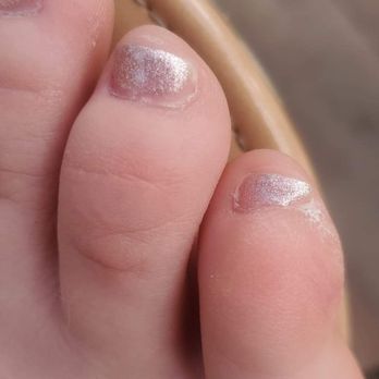 New Age Nail Studio - Right toes - Waxing Near Me - Chicago, Illinois