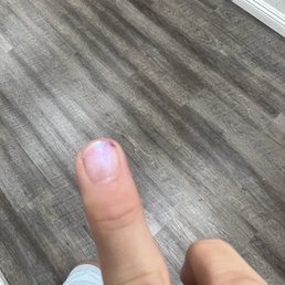 Damaged nail