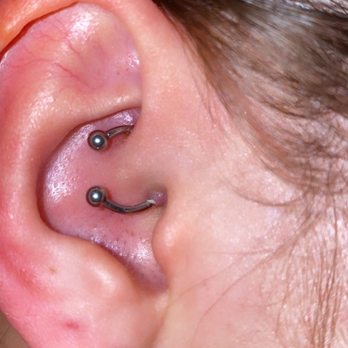 IIcon Piercing - Before; a botched Daith piercing - Piercing Near Me - Carmichael, California