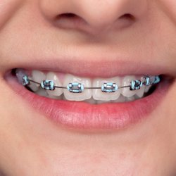 Gloria McMenamin, DDS - Pediatric care is important. Make your child's appoinment today!