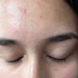 Hoboken Wellness Spa - She left marks in my forehead