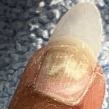 Nails 88 - Nail fungus on 4 of my fingers. - Nail Salons Near Me - Clarksville, Tennessee Nails 88 - Nail fungus on 4 of my fingers. - Nail Salons Near Me - Clarksville, Tennessee