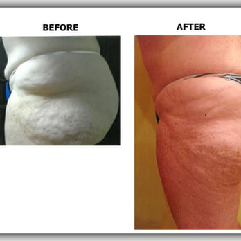 Joseph Fretta M.D - Body Contouring Near Me - Eatontown, New Jersey Joseph Fretta M.D - Body Contouring Near Me - Eatontown, New Jersey