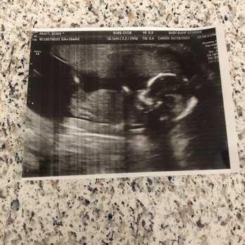 Baby Bump Studios  - Squish at 17 weeks #BabyBumpStudios - Diagnostic Imaging Near Me - Ontario, California