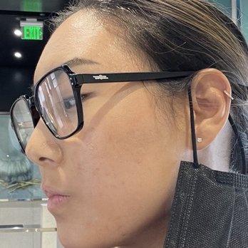 The Estheticians - September 2021, lightened scarring and improved texture. With a light layer of makeup. - Skin Care Near Me - San Mateo, California The Estheticians - September 2021, lightened scarring and improved texture. With a light layer of makeup. - Skin Care Near Me - San Mateo, California