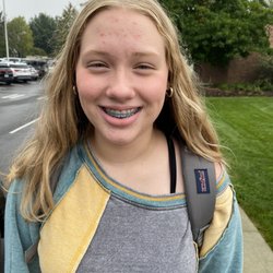 Nordberg Orthodontics - Before