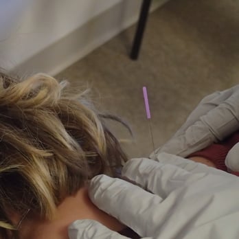 Atlas Physical Therapy - Trigger Point Dry Needling - Physical Therapy Near Me - Denver, Colorado