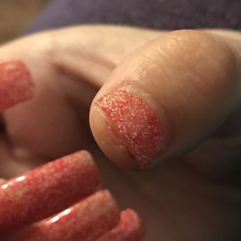 Annie's Nails - Healing a little less than a week. - Nail Salons Near Me - San Jose, California Annie's Nails - Healing a little less than a week. - Nail Salons Near Me - San Jose, California