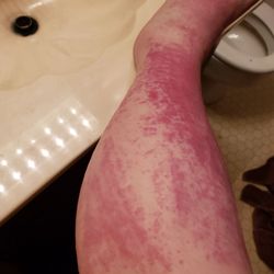 CA Nails - Thought the deluxe pedicure was great until I saw the scratches from it. Caused an infection in both my legs. Worst pedicure I've ever had.