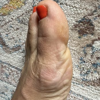 Neon Nails & Spa - Calluses still remain on the sides of my toes. - Nail Salons Near Me - Ventura, California