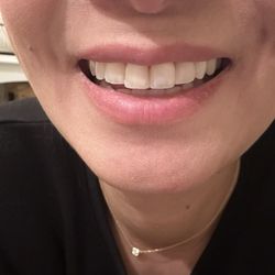 Mora Family Dentistry - After