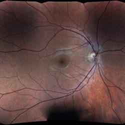 Sight Eyecare