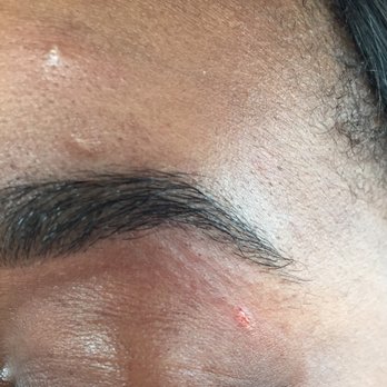 Everest Eyebrow Threading Salon - Here's a picture of where I was cut during the threading process. I now have a scar from the cut. - Threading Services Near Me - Dallas, Texas Everest Eyebrow Threading Salon - Here's a picture of where I was cut during the threading process. I now have a scar from the cut. - Threading Services Near Me - Dallas, Texas