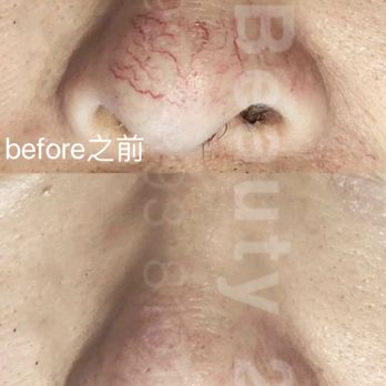 X Beauty 29 - Skin Care Near Me - Flushing, New York