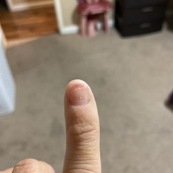 Nail Care - My pinky looked so much worse but the pain is still present and it's been 2 days. - Nail Salons Near Me - Manteca, California Nail Care - My pinky looked so much worse but the pain is still present and it's been 2 days. - Nail Salons Near Me - Manteca, California