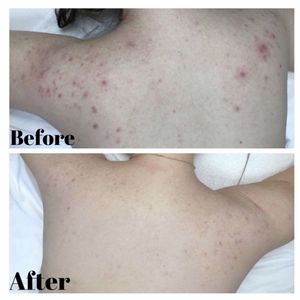 New Look Skin Center 124 Photos 1443 Reviews Skin Care 17200 Ventura Blvd Encino Encino Ca United States Phone Number Yelp