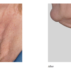 Skin Solutions