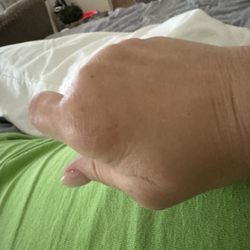 Maryland Oncology Hematology - Swollen hands to a bad reaction. Kim did nothing but try to argue with me when I was having trouble breathing.