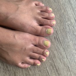 Pedicure