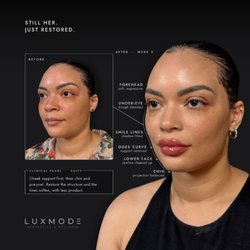 Luxmode Aesthetics & Wellness - Facial rejuvenation