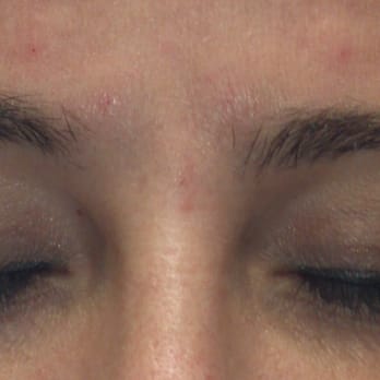 The Skin Corner - Before. It had been a long time since I'd had my brows done and they are not well-kept. But they made it worse. - Skin Care Near Me - Sacramento, California The Skin Corner - Before. It had been a long time since I'd had my brows done and they are not well-kept. But they made it worse. - Skin Care Near Me - Sacramento, California