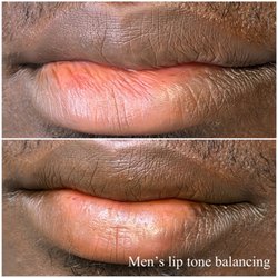 Men's lip neutralization
