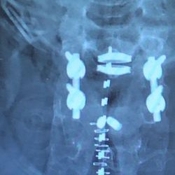 Center for Interventional Pain & Spine - Exton