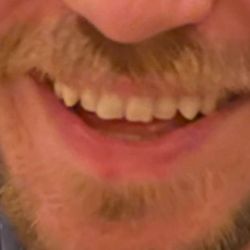 Confident Smiles - Before