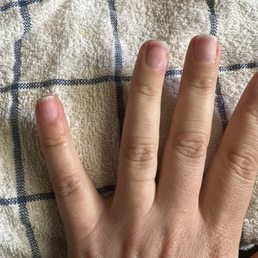 Nails red and sensitive after a bad electric file experience