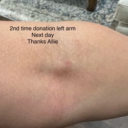 Biomat USA - Awesome Allie